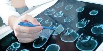 中医传奇！非遗项目沙袋循经拍打疗法在脑瘫康复领域获得重大突破